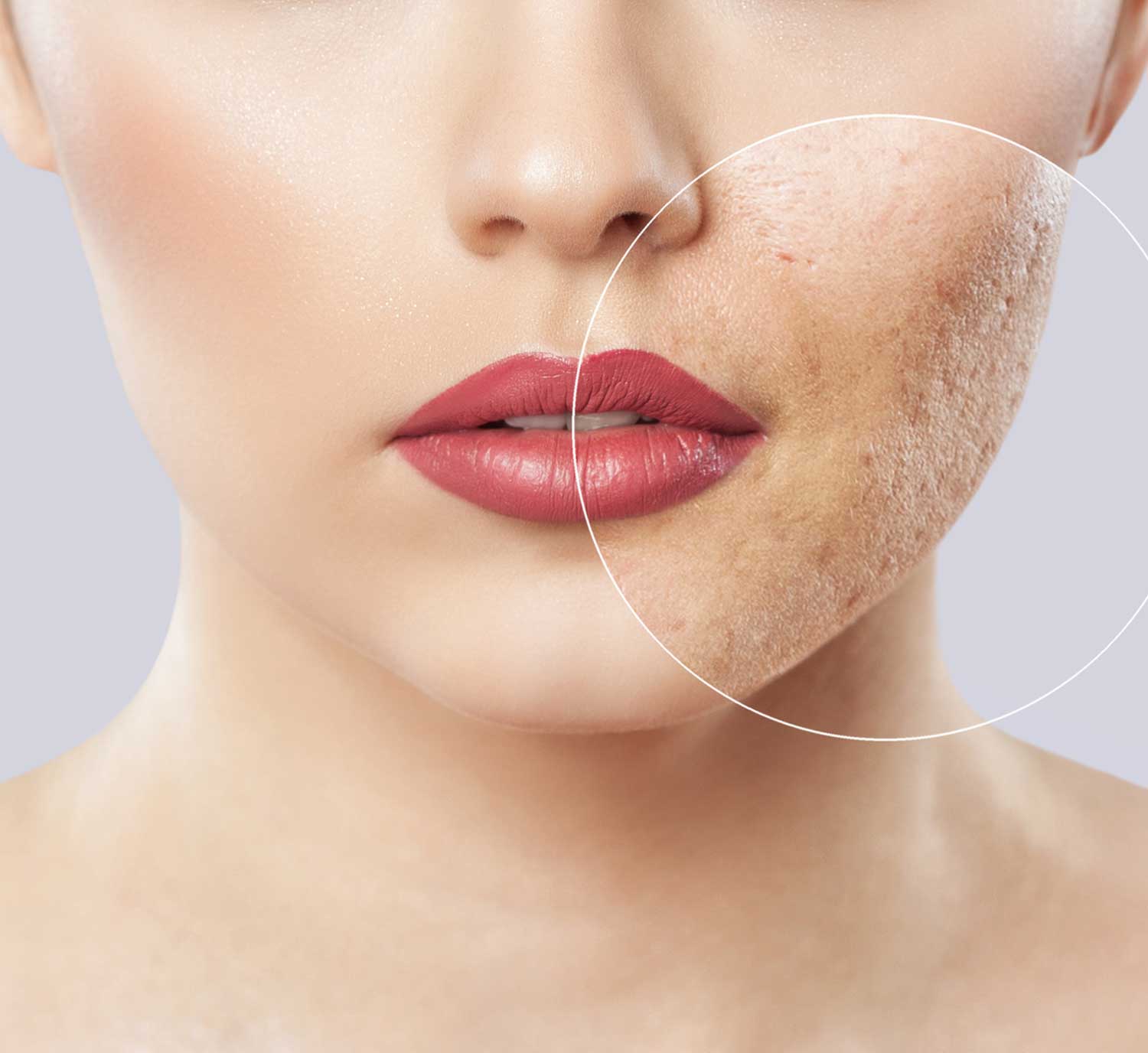 Topsi Hautbedürfnisse: Erste Hilfe für unreine, großporige und vernarbte Haut